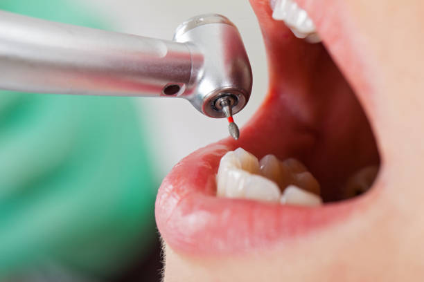 Best Emergency Dentist for Special Needs Patients in Anthony, KS